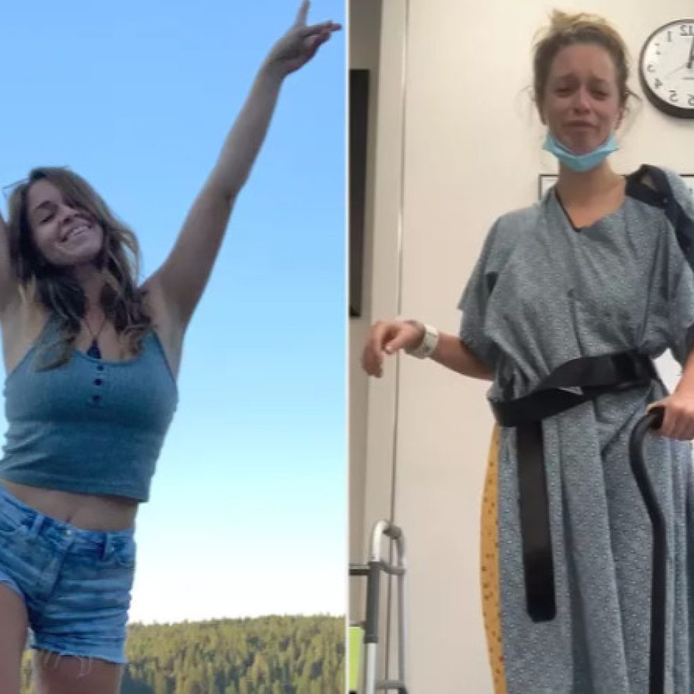 γυναίκα πριν και μετά από παρενέργειες που της προκάλεσε ένα αντιβιοτικό