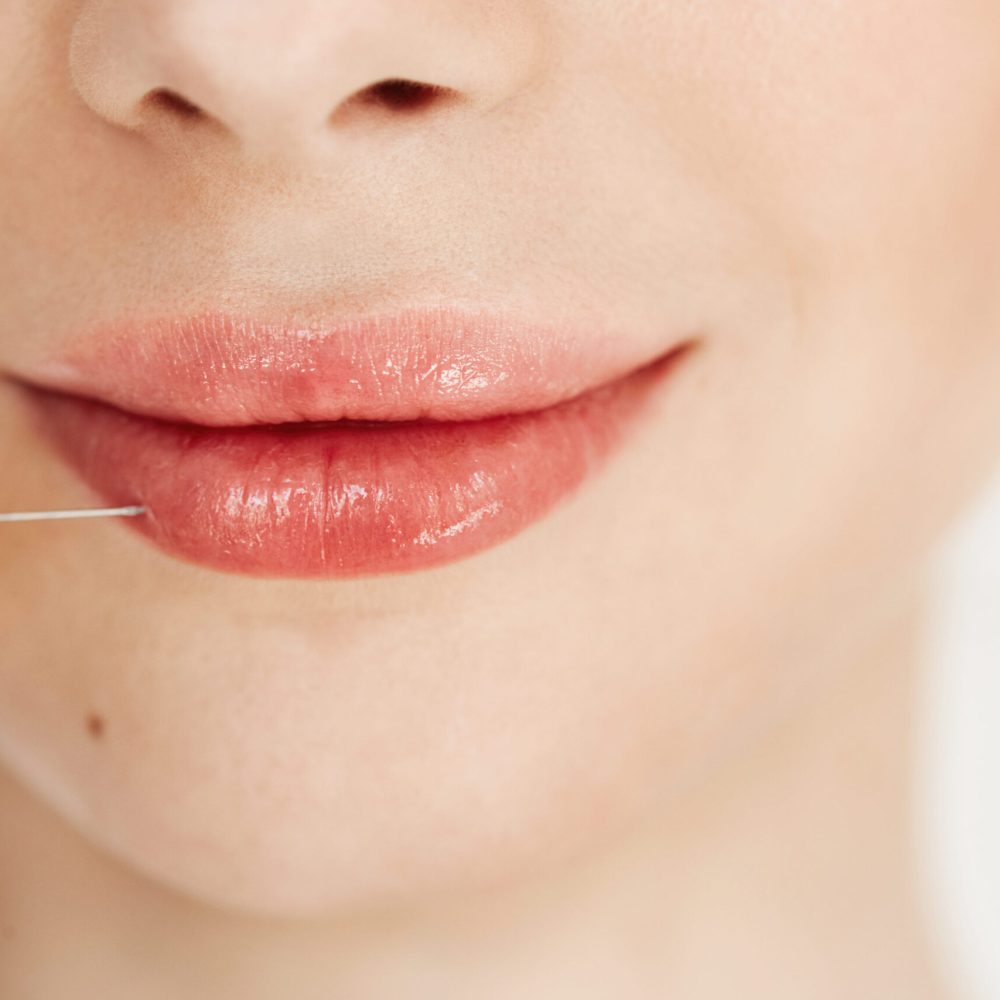 hyaluronic-acid-lips